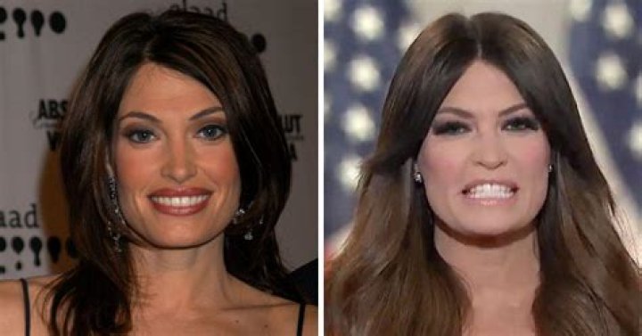 Kimberly Guilfoyle Surgery: Insights, Impact, and Recovery Journey