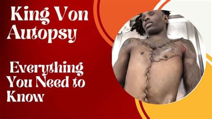 King Von Autopsy Released: Understanding the Impact and Insights Behind the Findings